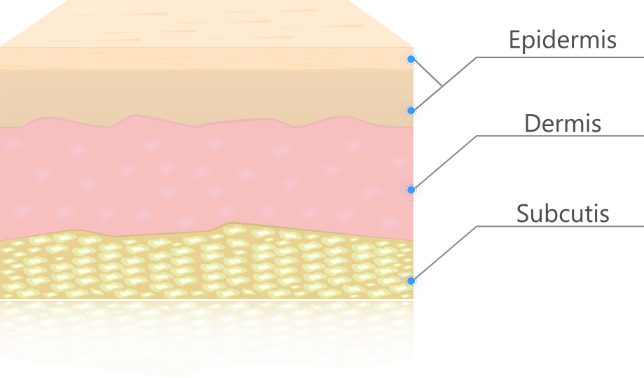 chemical-peel-skin-layers