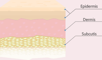chemical-peel_skin-layers