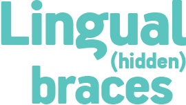 Lingual (hidden) braces