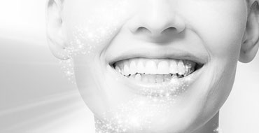 Tooth whitening