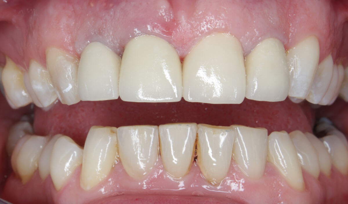 {my}dentist, Hessle High Road, Hull Hull HU4 6SB Dental Practice