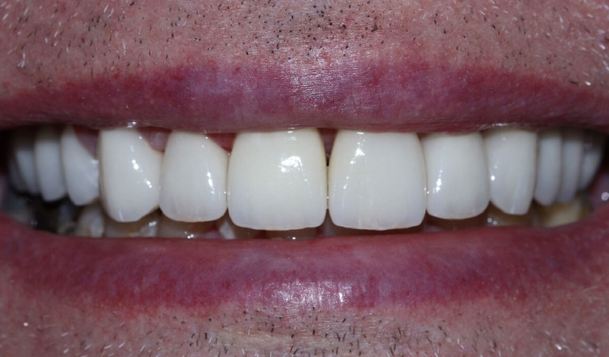 {my}dentist, Westbrook Centre, Warrington Warrington