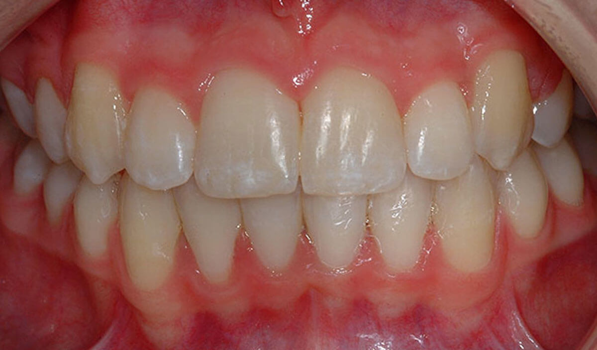 Beverley Orthodontic Centre Beverley HU17 9HL Dental Practice Details