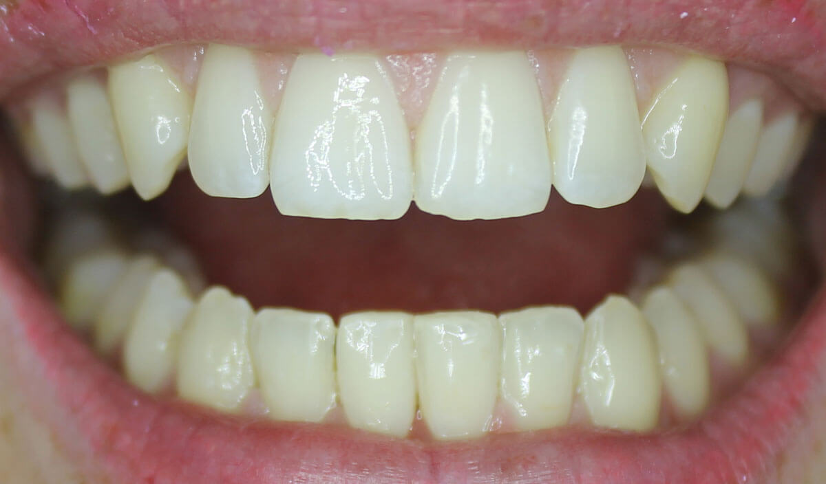 {my}dentist, Peel Street, Barnsley Barnsley S70 2RA Dental Practice Details