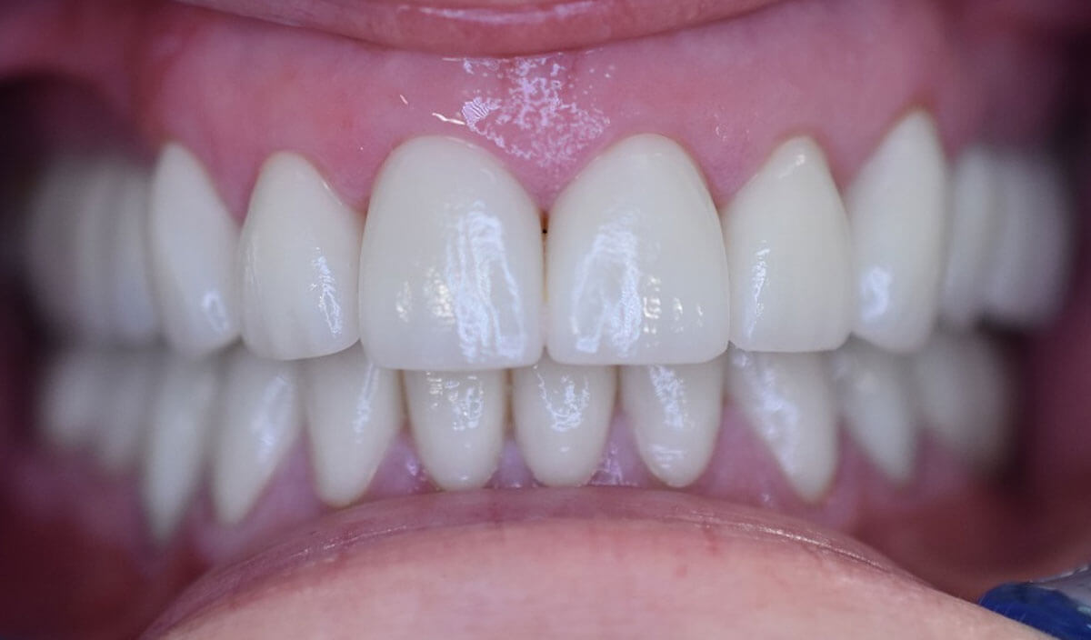 {my}dentist, Peel Street, Barnsley Barnsley S70 2RA Dental Practice Details