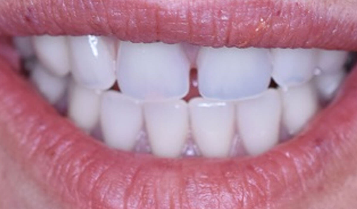 {my}dentist, Peel Street, Barnsley Barnsley S70 2RA Dental