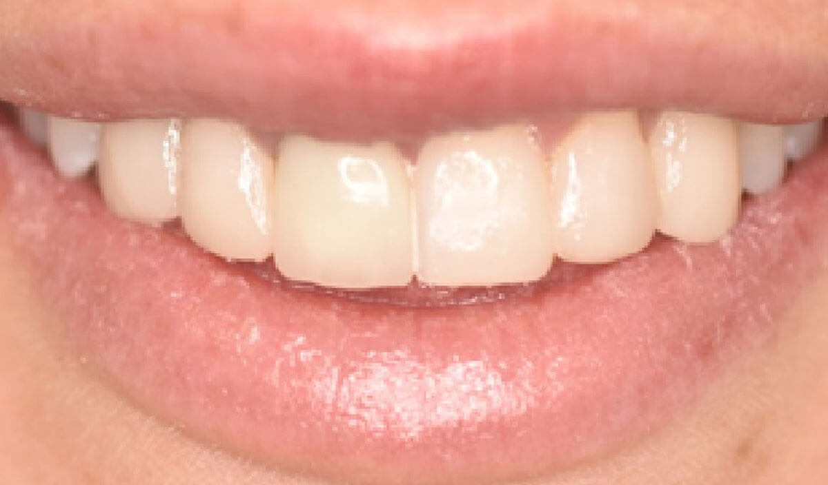 {my}dentist, Dean Road, South Shields Tyne and Wear NE33 4AR