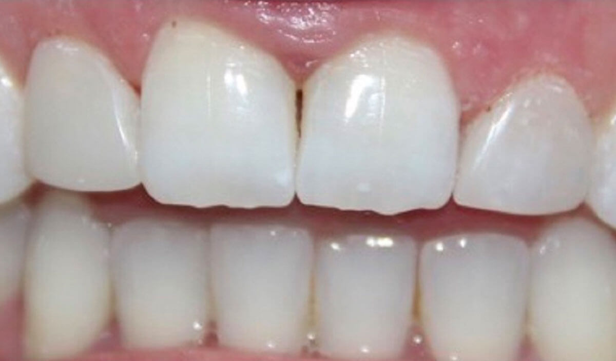 {my}dentist, Kenton Park, Gosforth Newcastle upon Tyne NE3 4RU Dental Practice Details