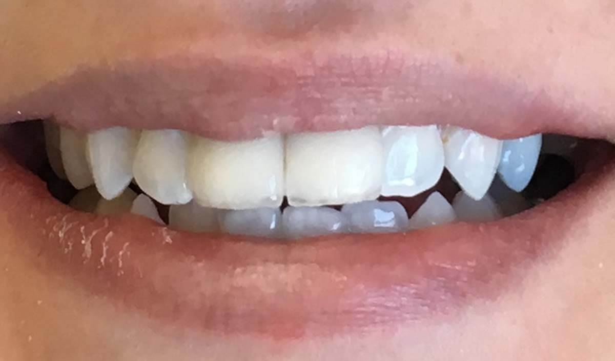 {my}dentist, Crosby Road South, Liverpool Liverpool L22 1RG