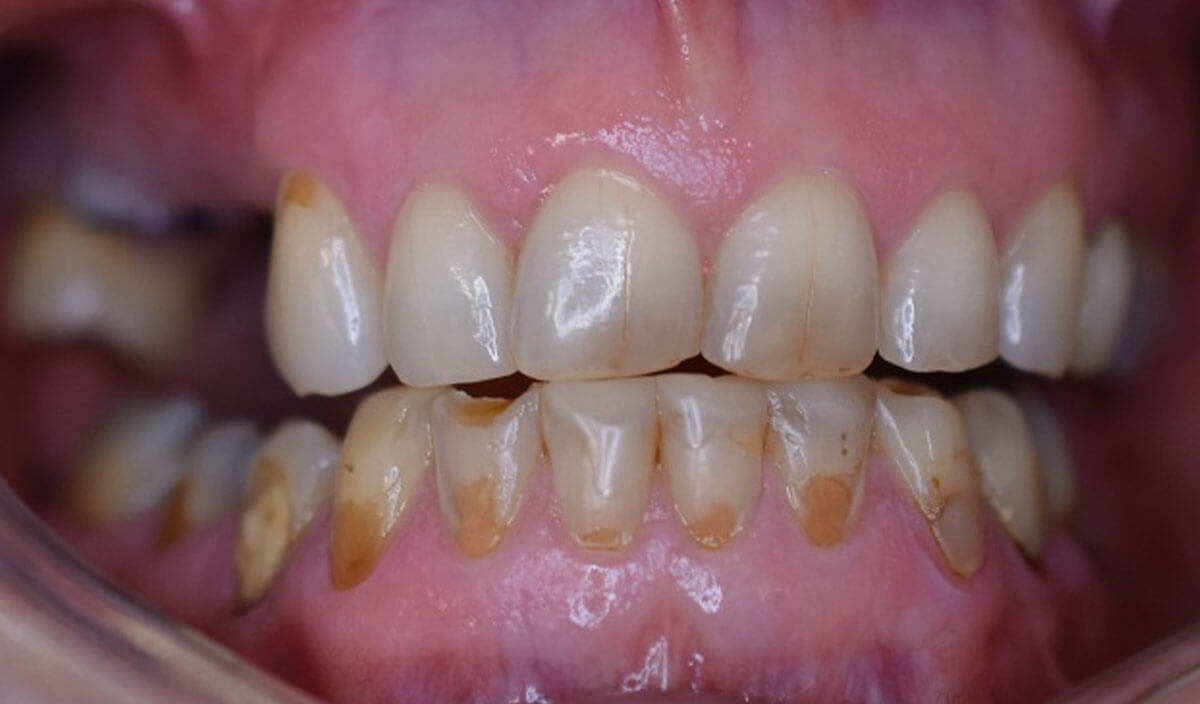 {my}dentist, Peel Street, Barnsley Barnsley S70 2RA Dental Practice Details