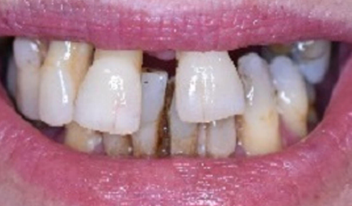 {my}dentist, Peel Street, Barnsley Barnsley S70 2RA Dental Practice Details