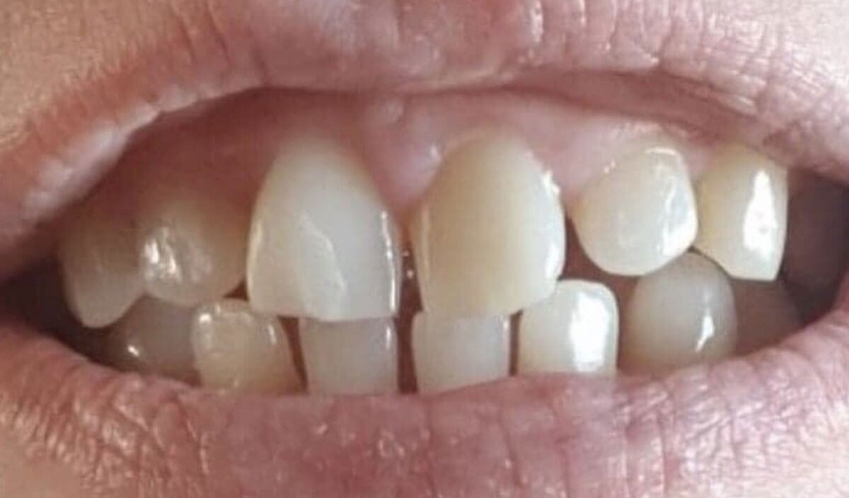 {my}dentist, Dean Road, South Shields Tyne and Wear NE33 4AR