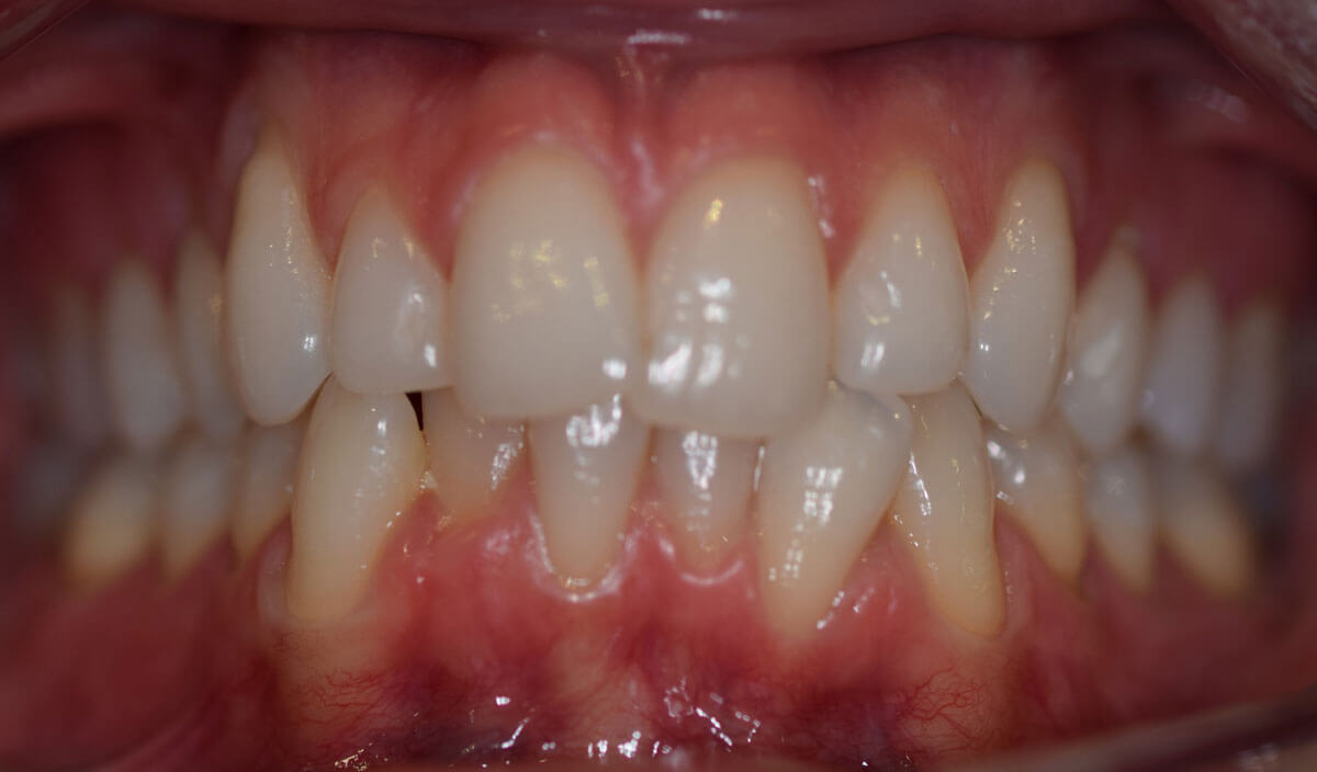 {my}dentist, Standishgate, Wigan Wigan WN1 1XP Dental Practice