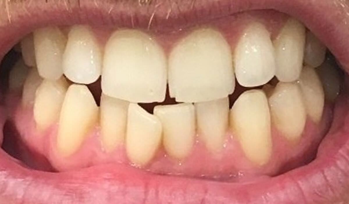 {my}dentist, Westbrook Centre, Warrington Warrington WA5 8UG Dental Practice Details