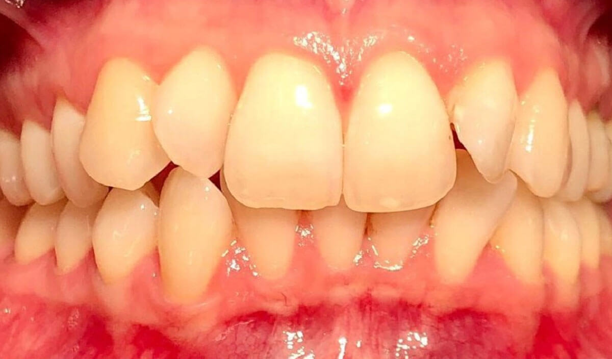 {my}dentist, Ida Road, Skegness Skegness PE25 2AR Dental Practice