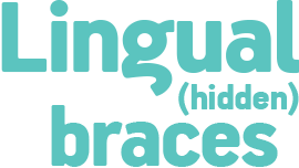 Lingual (hidden) braces